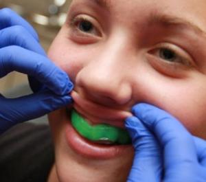 7 Facts About Your Sports Mouth Guard